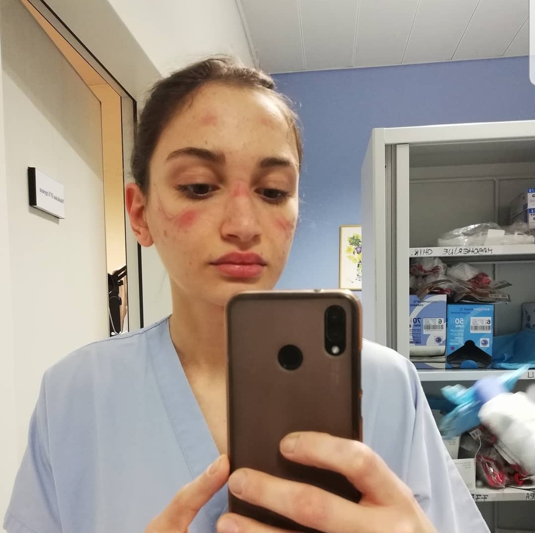 „Stați acasă, nu vă bateți joc de eforturile noastre!” Apelul și vânătăile unei tinere asistente medicale din Italia
